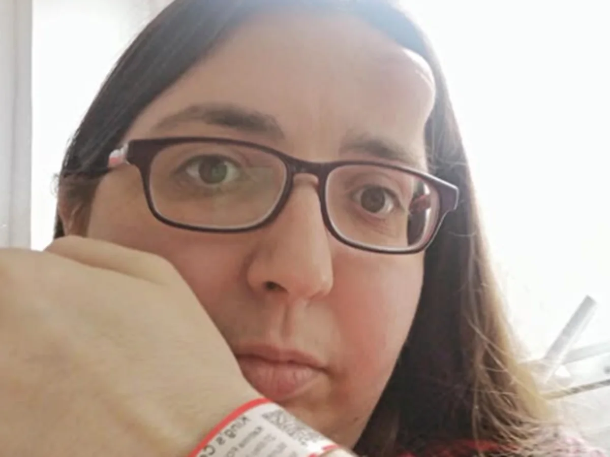 Mulher descobre câncer após caroço abrir buraco de 3 cm no crânio