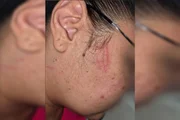 A profissional de saúde foi atacada por uma paciente